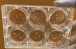 SCIENTISTS GROW MINIATURE BRAINS THAT MIMIC THE MAJOR PATHOLOGICAL FEATURES OF PARKINSON’S DISEASE