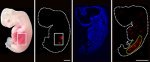 Early-stage human kidneys grown in pigs for first time