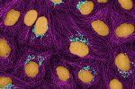Hundreds of Cancer Papers Mention Nonexistent Cell Lines