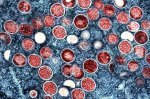 Rattled by mpox surge in Africa, WHO declares a global health emergency—again