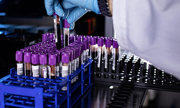 Geneetiline kohanemine avalikustatud: Paapua Uus-Guinea ainulaadse evolutsioonilise teekonna uurimine