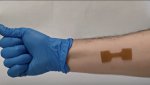 Programmable 3D printed wound dressing could improve treatment for burn, cancer patients