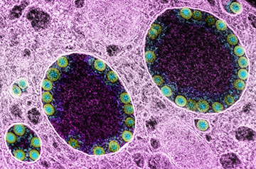Chinese Researcher Submitted First SARS-CoV-2 Genome to U.S. Database, Sparking Controversy Over Early Disclosure