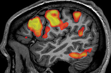 Scientists use AI to decipher words and sentences from brain scans