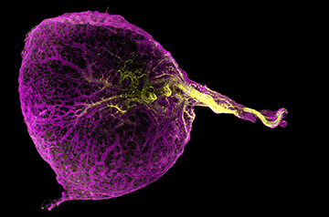 Three organs in one? Researchers unscramble mysterious roles of human yolk sac