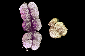 ‘Most troublesome chromosome’ gets new respect after full sequence