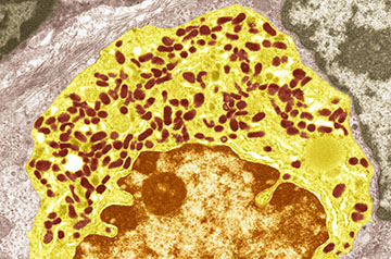 Low serotonin levels might explain some Long Covid symptoms, study proposes