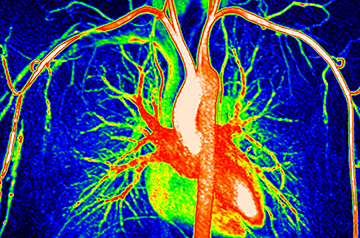 Unveiling Your Biological Clock: Blood Test Reveals Organ Aging and Disease Risk