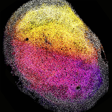 Groundbreaking Research: First Brain Organoids Grown from Fetal Tissue Shed Light on Developmental Mysteries