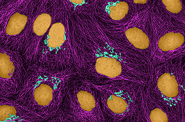 Hundreds of Cancer Papers Mention Nonexistent Cell Lines
