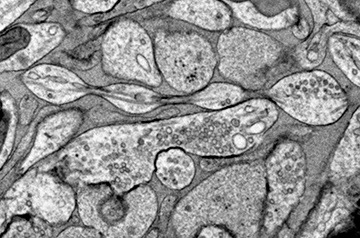 Controversial study redraws classical picture of the neuron