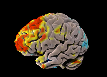 What accelerates brain ageing? This AI ‘brain clock’ points to answers