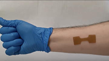 Programmable 3D printed wound dressing could improve treatment for burn, cancer patients
