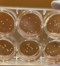 SCIENTISTS GROW MINIATURE BRAINS THAT MIMIC THE MAJOR PATHOLOGICAL FEATURES OF PARKINSON’S DISEASE