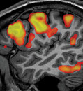Scientists use AI to decipher words and sentences from brain scans