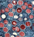 WHO ends mpox emergency