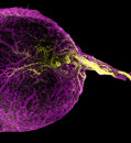 Three organs in one? Researchers unscramble mysterious roles of human yolk sac