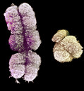 ‘Most troublesome chromosome’ gets new respect after full sequence