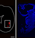 Early-stage human kidneys grown in pigs for first time