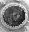 Stress turns tiny worm into a big-mouthed cannibal
