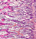 More than red blood cells depend on hemoglobin, surprising study of cartilage reveals
