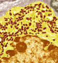 Low serotonin levels might explain some Long Covid symptoms, study proposes