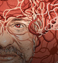 Controversial Findings Surrounding Stroke Drug and Alzheimer's Research Raise Questions About Scientific Integrity