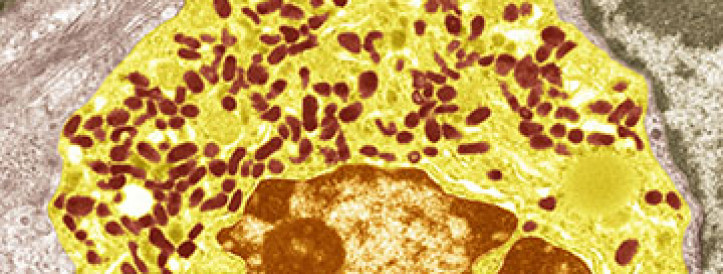 Low serotonin levels might explain some Long Covid symptoms, study proposes