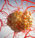 Failed cancer therapy revived as powerful tumor killer when combined with newer drugs