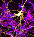 Could fused neurons explain COVID-19’s ‘brain fog’?