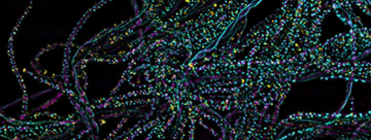 One photon is all it takes to kick off photosynthesis