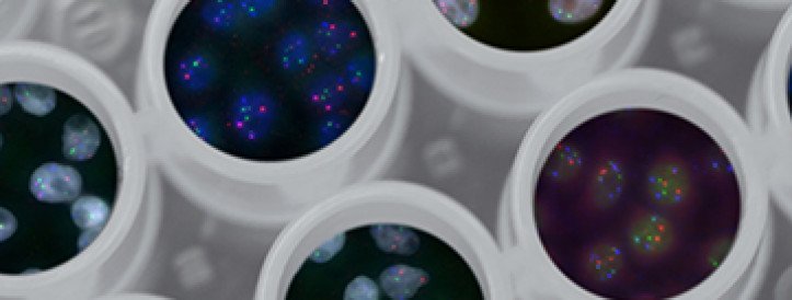 A solution for secure analysis of genetic data developed in Estonia