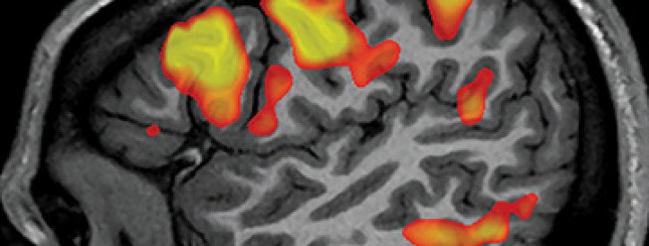 Scientists use AI to decipher words and sentences from brain scans