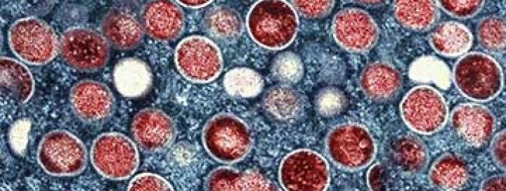 WHO ends mpox emergency