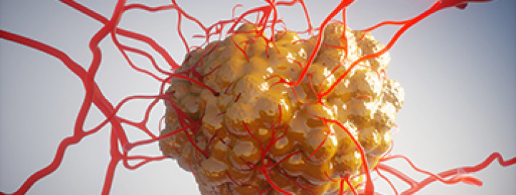 Failed cancer therapy revived as powerful tumor killer when combined with newer drugs