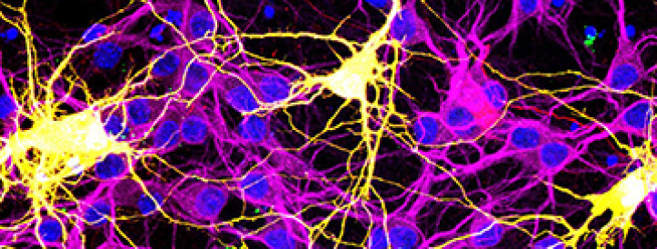 Could fused neurons explain COVID-19’s ‘brain fog’?