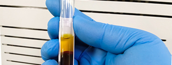 Can ‘toxic’ bilirubin treat a variety of illnesses?