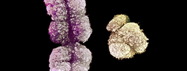 ‘Most troublesome chromosome’ gets new respect after full sequence