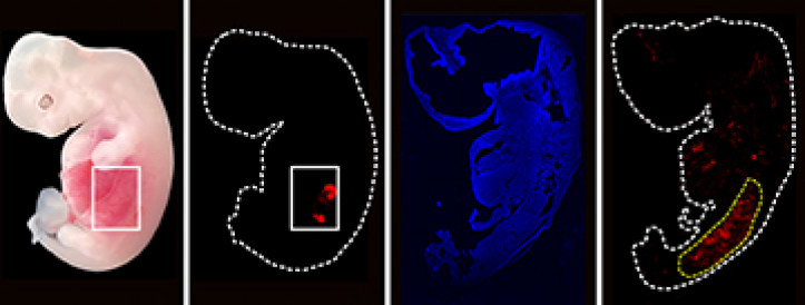 Early-stage human kidneys grown in pigs for first time