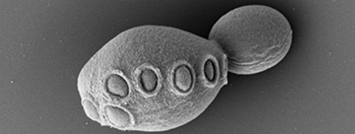 Synthetic yeast project unveils cells with 50% artificial DNA