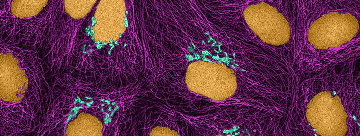 Sajad vähktõvega seotud dokumendid mainivad olematuid rakuliine