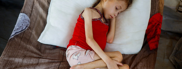 Teadlased ütlevad, et näljahäda väljakuulutamise kõrge lagi võib abi edasi lükata