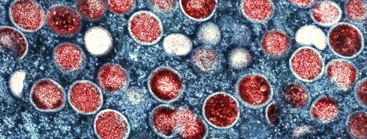 WHO kuulutab ülemaailmseks tervishoiu hädaolukorraks - taas kord - mürgituse tõttu Aafrikas.