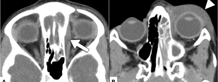 Ajakiri võtab artikli tagasi plagiaadipiltide pärast seda, kui ta püüdis kaebuse esitanud teadlast vaigistada