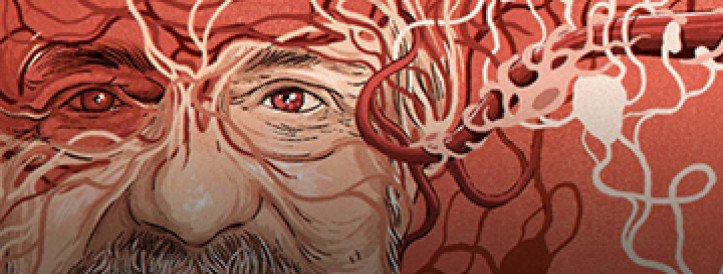 Controversial Findings Surrounding Stroke Drug and Alzheimer's Research Raise Questions About Scientific Integrity