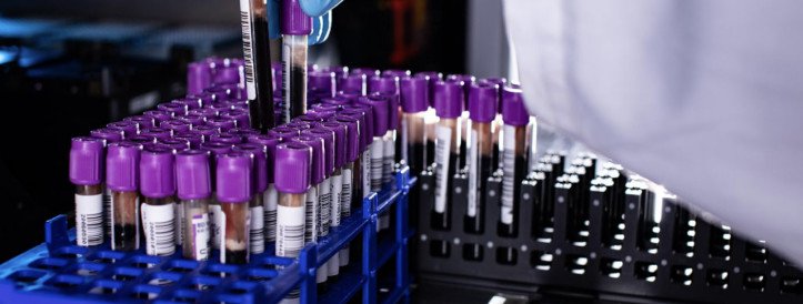 Geneetiline kohanemine avalikustatud: Paapua Uus-Guinea ainulaadse evolutsioonilise teekonna uurimine